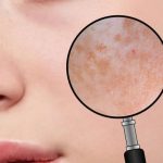 Kozmetikai és orvostechnikai kezelések Dunakeszin: férfi kozmetika, lézeres szőrtelenítés, gyantázás, wax, carbon peeling, végleges szőrtelenítés, fülbelövés, intimgyanta, mikrotűs mezoterápia, pigment halványítás, aknés bőr, fibróma eltávolítás, hydrabeauty, szempilla dauer lifting, mikrodermabrázió, hydra face, hydra facial, rosacea hajszálér kezelés, medical piercing, fülakupunktúra, tetoválás eltávolítás, savas hámlasztás. Göd, Fót, Budakalász, Vác, Veresegyház, Újpest környékén